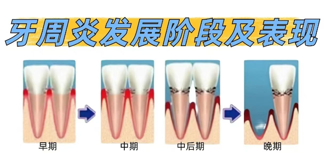 优贝口腔商辉辉：深耕牙周根管诊疗，专攻复杂牙体与儿童口腔问题